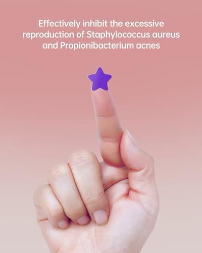 Jefusst Star Acne Pimple Patch 140 Counts, Hydrocolloid Acne Patches for Face, Purple, Blue, Green, Pink and Yellow view 3