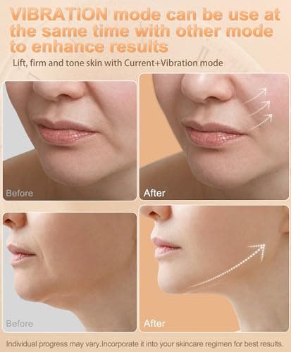 Radio-Frequency Skin Tightening Device | 6 in 1 Home-RF Face Beauty Device | Professional Facial Skin Tightening | Lifting | Wrinkle Reducing | Anti Aging | Depuff | Increase Absorption(with Gel) view 5