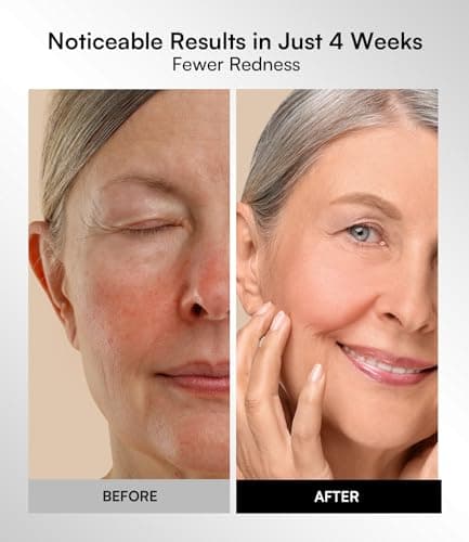 INIA Red Light Therapy Mask for Face – 4 Light Modes with 850nm NIR, Red & Blue LED Light Therapy, 2600mAh Rechargeable LED Face Mask for Radiant Glow at Home, Black view 5