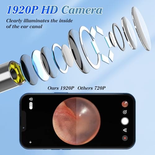 LMECHN Ear Wax Removal, Earwax Remover 1920P Otoscope, Built-in WiFi, IP67 Waterproof and 8 Ear Tips, Earwax Removal Tools Camera for iOS & Android Suitable for Beginners, Type-C Charging. view 3