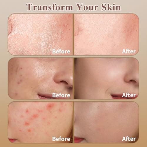 WEAUUP Beef Tallow for Skin, Organic Grass Fed Whipped Beef Tallow Balm, Tallow and Honey Balm with Raw Honey and Beeswax, Nourishing Moisturizer for Face & Body Natural Skin Care for Soft view 4