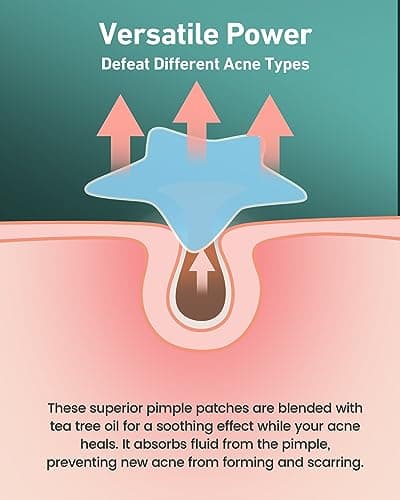 Jefusst Star Acne Patches 112 Counts, Pimple Patch Pimple Patches for Face Pimple Patches Stars Hydrocolloid Acne Patches Cute Zit Patches Healing Sticker, Blue and Pink view 4