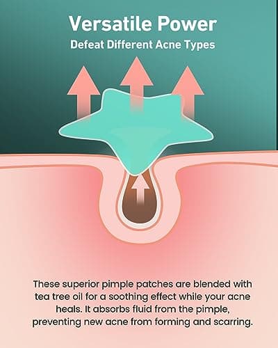 Jefusst Pimple Patches for Face, 168 Patches, Hydrocolloid Acne Patches, Cute Star Pimple Patch for Healing Stickers with Tree & Salicylic 2 Sizes, Zit Covers view 3