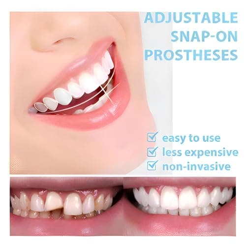 2 Pairs of Smile Supports Can Be Adjusted Freely Suitable for All Adults (Up and Down) and Smile Quickly and Confidently view 2