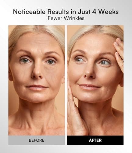 INIA Red Light Therapy Mask for Face – 4 Light Modes with 850nm NIR, Red & Blue LED Light Therapy, 2600mAh Rechargeable LED Face Mask for Radiant Glow at Home, Black view 4