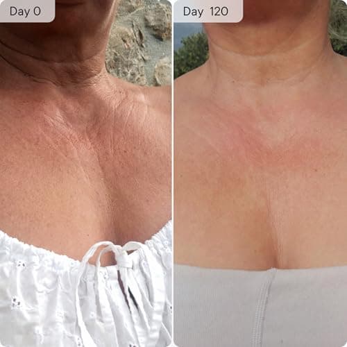 Qure Neck, Décolletage, Chest LED System, Red Light Therapy, 2 Wavelengths Red 633nm and Near-Infrared 830nm view 6