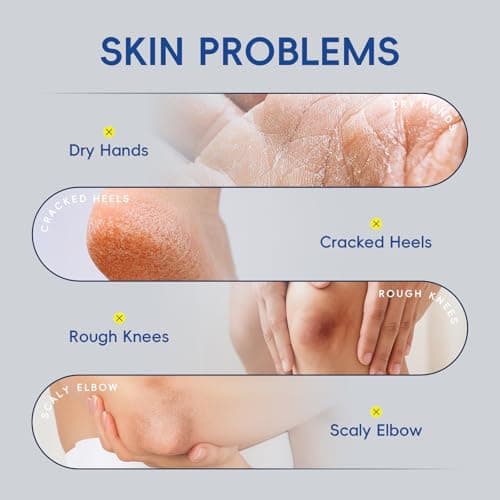 2 Pack Urea Cream 40% + 2% Salicylic Acid, 3.53 oz - Maximum Strength Foot & Hands Moisturizer for Rough, Dry Cracked Skin, Callus Remover with Deep Hydration, Intensive Repair for Feet, Heels view 4