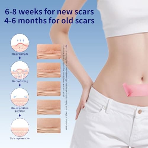 Silicone Scar Sheets 1.6"x39.4" Roll-1M Scars Removal Treatment Medical Grade Silicone Scar Tape for Skin Resuable Strip for Tummy Tuck,Incision,Keloid,C-Section,Burn,Acne Scars(white) view 3