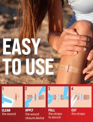 Emergency Wound Closure Strips - 11pk - 2 Types Easy to Use Butterfly Bandages - Stitchless & Painless Laceration Closure Kit view 5