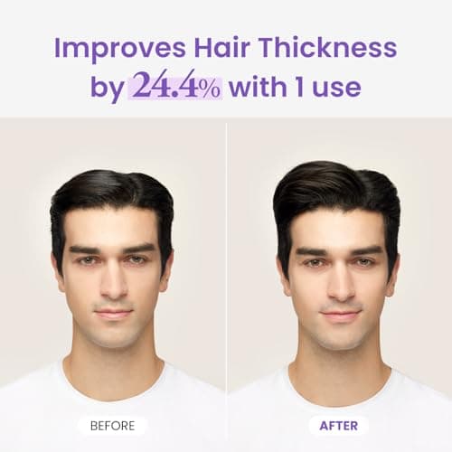 Dr.groot Rosemary Mint Oil Tonic for Hair Growth with Biotin, Hyaluronic Acid, Thickening & Scalp Nourishing. Korean Haircare. Sulfate-Free, Silicon-Free, Paraben-Free (3.38 fl oz/ 100ml) view 5