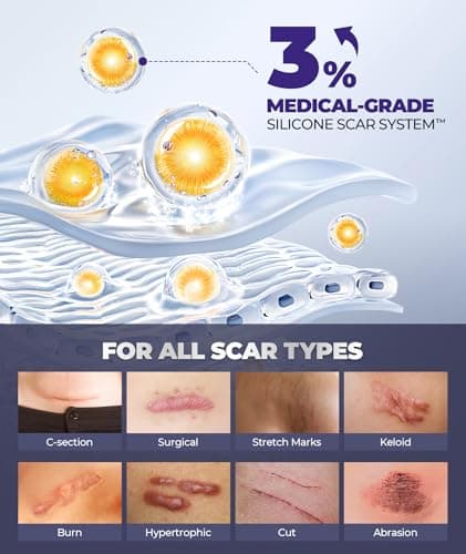 Silicone Scar Cream with 6.7% Active Ingredients, Scar Gel Visible in 2 Weeks, Moisturizing Scar Removal Clinically Show for Surgical, C-Section, Keloid, Acne & Burn Scars, Stretch Mark Cream(55ML) view 6