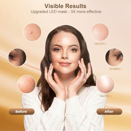 AIUO Red Light Therapy for Face, LED Face Mask Light Therapy, Rechargeable Red Light Therapy Mask for Face with Comfortable Light-Blocking Eye Protection & Timing Function At Home, Black view 3