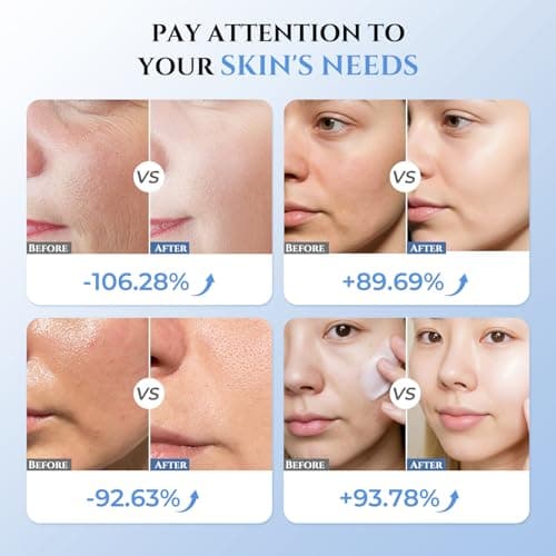 Oranmagic Microcurrent Facial Device - 5-in-1 Skin Tightening & Lifting Facial Machine - 5 Color Face Light Therapy Device - Professional Skin Care Tone Beauty Devices for Face, Neck, and Eye Area view 3