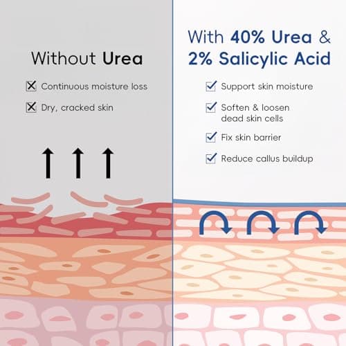 2 Pack Urea Cream 40% + 2% Salicylic Acid, 3.53 oz - Maximum Strength Foot & Hands Moisturizer for Rough, Dry Cracked Skin, Callus Remover with Deep Hydration, Intensive Repair for Feet, Heels view 6