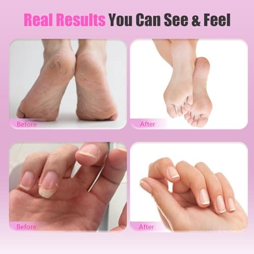 Electric Callus Remover for Feet – 2-in-1 Rechargeable Foot Sander with Sandpaper Discs & Nail Drill Bits, Adjustable Speed, LED Display, Professional Pedicure Tool for Home & Travel view 7