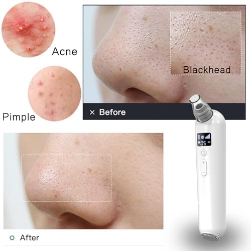 Vacuum Blackhead Remover Pore Cleaner with Heat & Red Light 5 Suction Levels Nose Pore Cleaner Rechargeable with LED Display, 6 Probes & Bonus Blemish Extractor Tools, Skincare Gift for Women view 2
