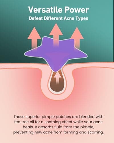 Jefusst Star Acne Pimple Patch 140 Counts, Hydrocolloid Acne Patches for Face, Purple, Blue, Green, Pink and Yellow view 4