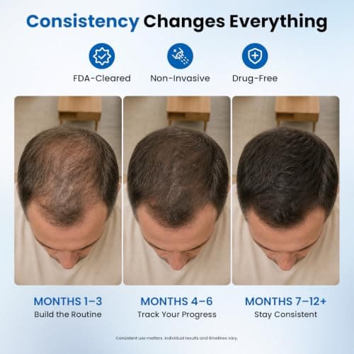 CAYAMA Laser Hair Growth Cap, 320 Lasers & LEDs, FDA-Cleared | 650nm red light; soft cap for men & women; up to 300 minutes per charge view 5