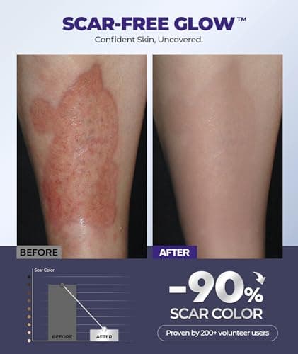 Silicone Scar Cream with 6.7% Active Ingredients, Scar Gel Visible in 2 Weeks, Moisturizing Scar Removal Clinically Show for Surgical, C-Section, Keloid, Acne & Burn Scars, Stretch Mark Cream(55ML) view 5
