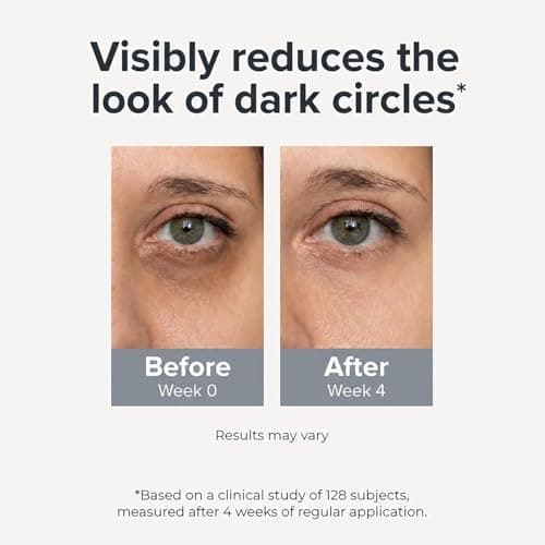 Under Eye Brightener Roller - Caffeine & Retinol Eye Serum for Dark Circles, Puffiness & Fine Lines, Travel Essential Vegan Skincare, Cooling Eye Massage, Dermatologist-Tested, 0.52 fl oz view 6