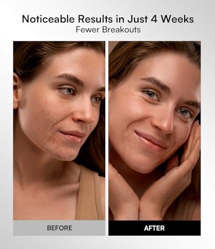 INIA Red Light Therapy Mask for Face – 4 Light Modes with 850nm NIR, Red & Blue LED Light Therapy, 2600mAh Rechargeable LED Face Mask for Radiant Glow at Home, Black view 6