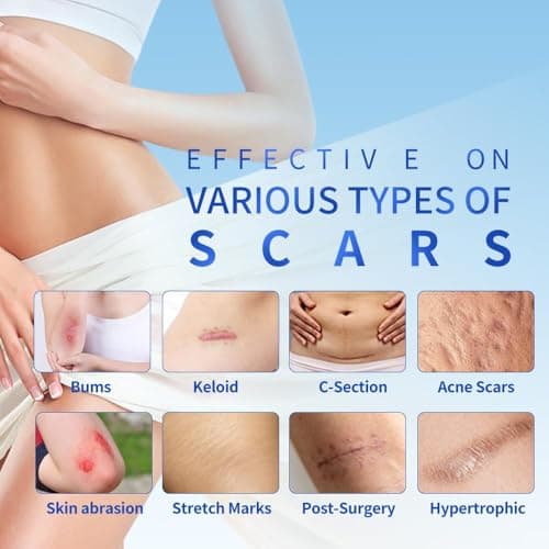 Safirst Silicone Scar Sheets 1.6"x59" Roll-1.5M Scars Removal Treatment Medical Grade Silicone Scar Tape for Skin Resuable Strip for Tummy Tuck,Incision,Keloid,C-Section,Burn,Acne Scars view 3