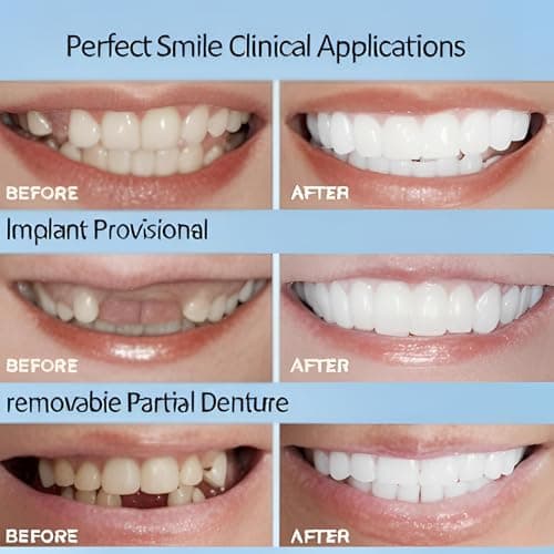 2 Pairs of Smile Supports Can Be Adjusted Freely Suitable for All Adults (Up and Down) and Smile Quickly and Confidently view 3