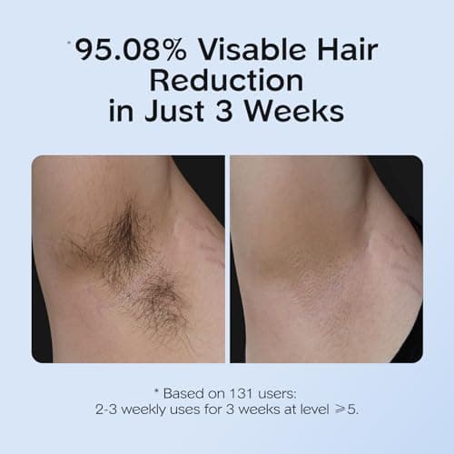 INNZA IPL Hair Removal with Ice Cooling Care Function for Women,Long-Lasting Results,999,999 Flashes Painless Hair Removal, Hair Removal Device for Armpits Legs Arms Bikini Line view 3