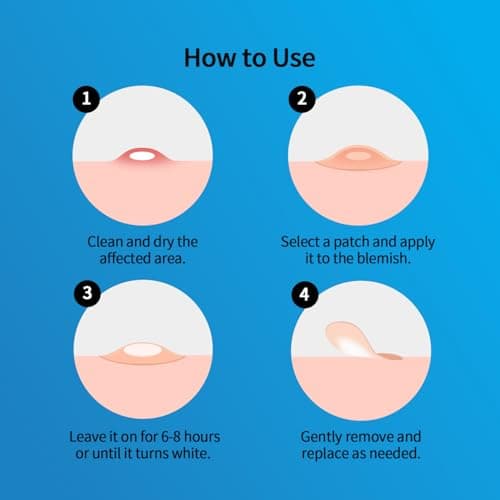 Pimple Patches for Face Hydrocolloid Acne Patches, Invisible Zit Stickers Covering Blemishes, 3 Size Hydrocolloid Spot Stickers for Face and Skin (144 Count(Pack of 1)) view 7