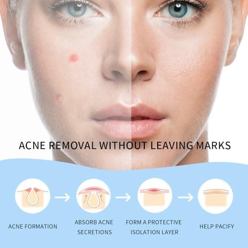 Safirst Star Acne Patches Hydrocolloid Pimple Absorbing Patch 3 Sizes 200 Counts Spot Blemish Stickers Zit Dot Colorful Cover Breakout Hiding Face Emergency Treatment view 6