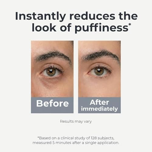 Under Eye Brightener Roller - Caffeine & Retinol Eye Serum for Dark Circles, Puffiness & Fine Lines, Travel Essential Vegan Skincare, Cooling Eye Massage, Dermatologist-Tested, 0.52 fl oz view 4