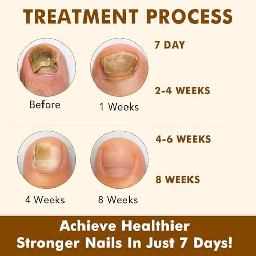 Tiuedu Nail Growth Serum, Ginger Nail Serum, Nails Repair Cuticles Oil, Ginger Nail Oil for Strengthen & Promote Nails Growth, Natural Plant Formula view 5