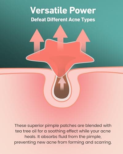 Jefusst Star Acne Patches 168 Counts, Pimple Patch Pimple Patches for Face Pimple Patches Stars Hydrocolloid Acne Patches Cute Zit Patches Healing Sticker, Pink, Blue and Orange view 4