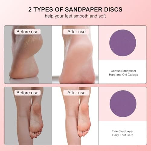 VISDOLL 2026 Upgrade Electric Foot Callus Remover, Ergonomic Foot File with 3 Speeds, Rechargeable, 20 Disposable Sandpaper Discs, Professional Pedicure Tool for Dead Skin & Calluses - Beige view 4