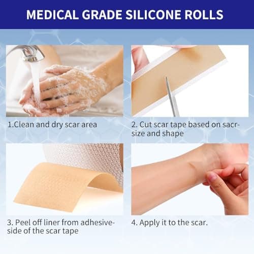 Safirst Silicone Scar Sheets 1.6"x59" Roll-1.5M Scars Removal Treatment Medical Grade Silicone Scar Tape for Skin Resuable Strip for Tummy Tuck,Incision,Keloid,C-Section,Burn,Acne Scars view 6