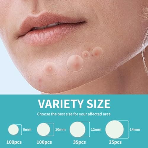 Safirst Sticky Acne Patches Hydrocolloid Pimple Absorbing Patch 4 Size 260 Counts Spot Blemish Invisible Stickers Zit Dot Cover Breakout Treatment view 3