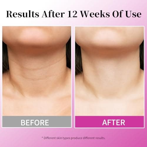 MRLILEI Tightening & Lifting Neck Cream view 5