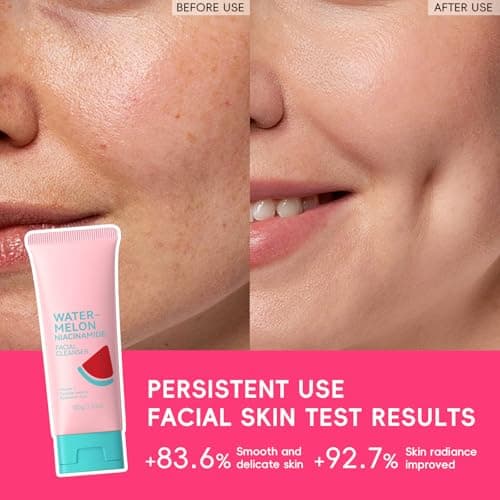 BeauBase Watermelon Niacinamide Face Wash, Foaming Facial Cleanser for All Skin, Face Wash for Women, Teens Girls, Gentle, Soften, Oil Control, Glow, Even Skin Tone, 3.53 Fl Oz/pcs (Pack of 3) view 6