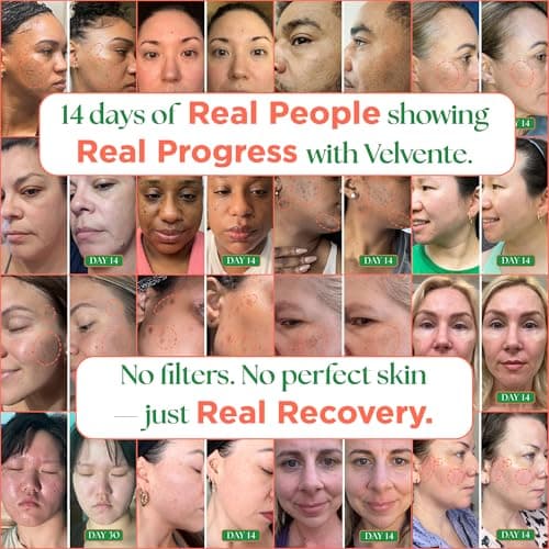 VELVENTE Matcha Facial Moisturizer with Rose PDRN, Korean Peptides Hydrating Firming Cream for Anti Aging, Dark Spot & Uneven Skin Tone, Soothing Radiance for Soft, Glowy Skin, All Skin Types, 3.53 oz view 6