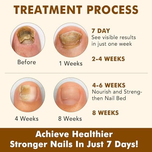 2PCS Ginger Nail Treatment, Nails Growth Serum, Nail Repair Cuticles Oil, Ginger Nail Serum Oil for Strengthen nails & Promote Nail Growth, Natural Plant Formula view 5