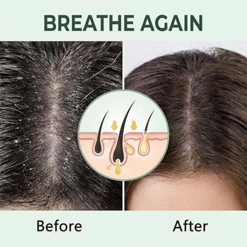 Avocado Oil Scalp Scrub - Deep Exfoliating Care for Dry, Itchy & Flaky Scalp - Natural Physical Exfoliant with Pumice, Aloe Vera & Peppermint - Vegan, 5.29 oz view 5