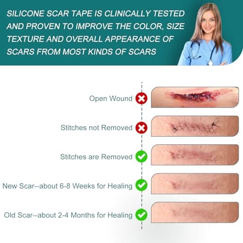 Silicone Scar Sheets (1.6"x 158" Roll-4M), Medical Grade Silicone Scar Tape view 4