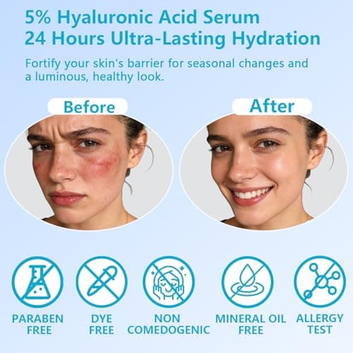 5% Hyaluronic Acid Serum for Face, 4D Multi-Layer Hydration, Ultra Hydrating Anti-Aging Serum, Moisturizer for Dry & Sensitive Skin, Pre-Makeup Skincare, Single-Use Ampoule 0.05fl oz x 30e view 5