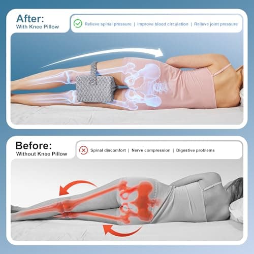 UJPFEO Knee Pillow for Side Sleepers view 2