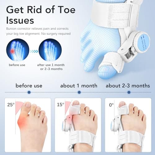 VEVARUN Bunion Corrector for Women Men: Big Toe Straightener Bunion Fix with Adjustable Knob-Orthopedic Bunions Splint Brace Toe Alignment Correction for Hallux Valgus Pain Relief Day/Night 1PCS (White) view 2