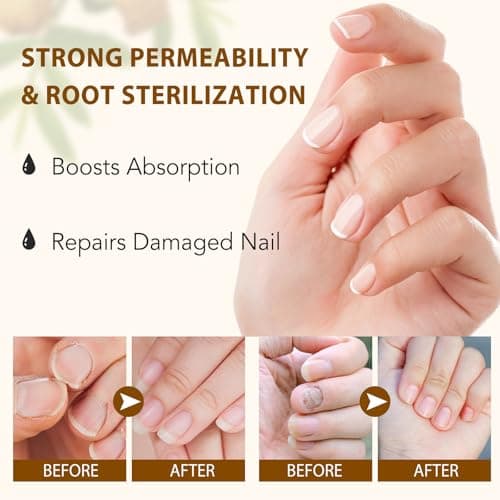 2PCS Ginger Nail Treatment, Nails Growth Serum, Nail Repair Cuticles Oil, Ginger Nail Serum Oil for Strengthen nails & Promote Nail Growth, Natural Plant Formula view 4