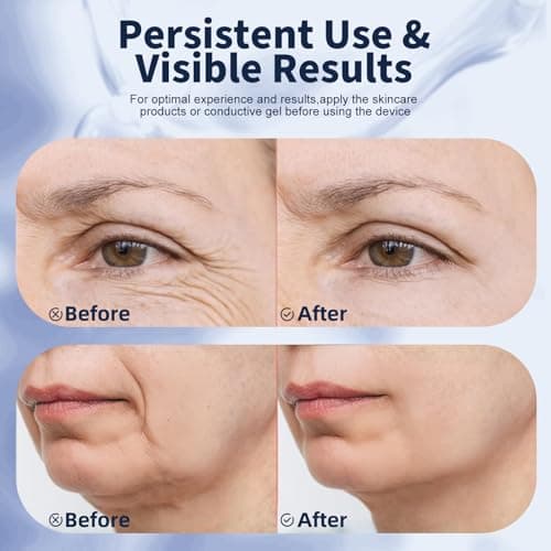 Red Light Therapy for Face, Multifunctional Face Massager with Micro-Current, LED Light Therapy & Vibration, at-Home Skin Care Face Sculpting Tool for Wrinkles, Micro-Current Facial Beauty Device view 4