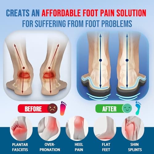 AOBEKOS Heavy Duty Plantar Fasciitis Insoles Men Women, 240lbs Ultimate Comfort High Arch Support Shoe Inserts, Work Boot Orthotic Insoles for Plantar Fasciitis, Flat Feet, Pronation and Heel Pain view 2