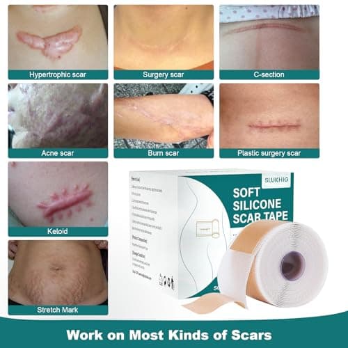 Silicone Scar Sheets (1.6"x 158" Roll-4M), Medical Grade Silicone Scar Tape view 3