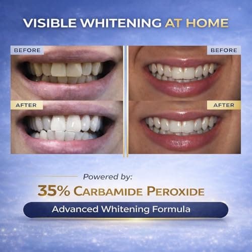 Advanced White Teeth Whitening Gel Refill Pack – 60 Treatments | 35% Carbamide Peroxide Professional Dental-Grade Gel | 3×10 mL Syringes | Restore+ Nano-Hydroxyapatite Toothpaste | Trays Not Included view 4